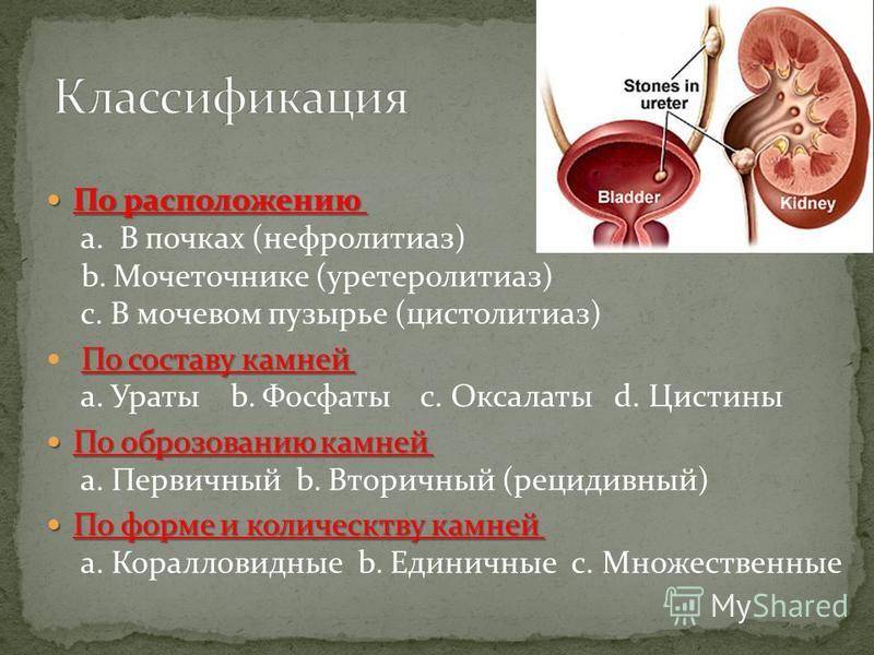 Камень в почке — что делать? профилактика и лечение