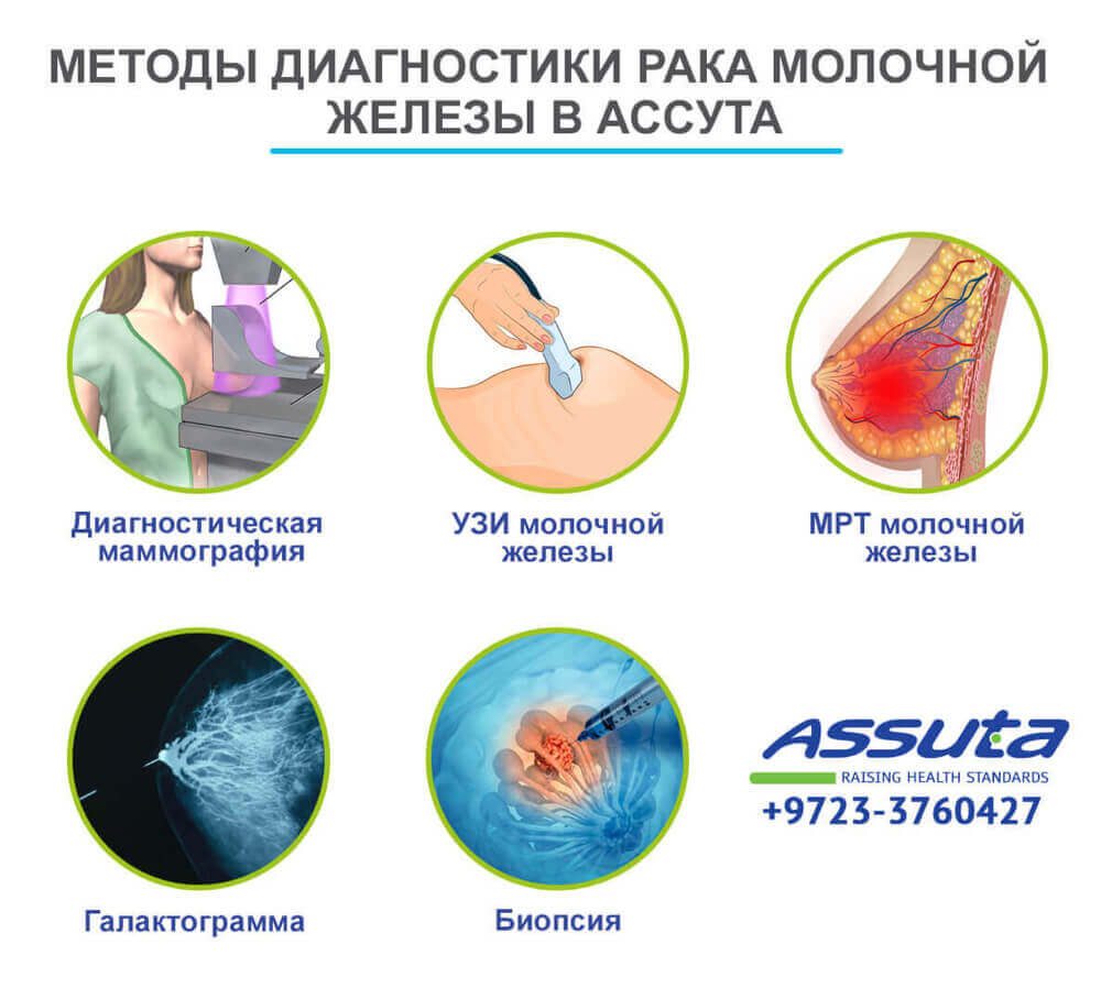 Диагностика железа. Опухоль молочной железы диагностика. Методы диагностики в онкологии. Методы диагностики опухолей молочных желез.. Алгоритмы диагностики опухоли молочной железы.