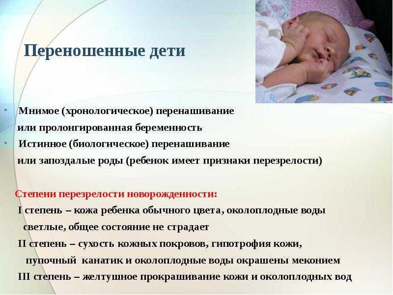 Роды в израиле