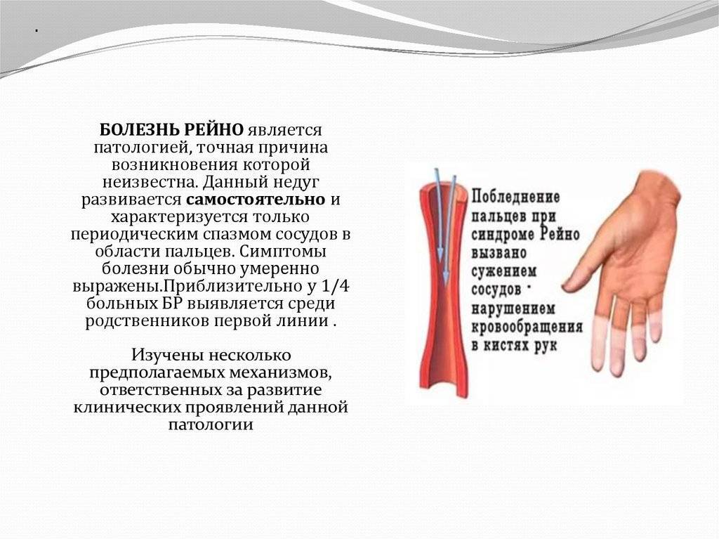 Феномен рейно: почему белеют пальцы