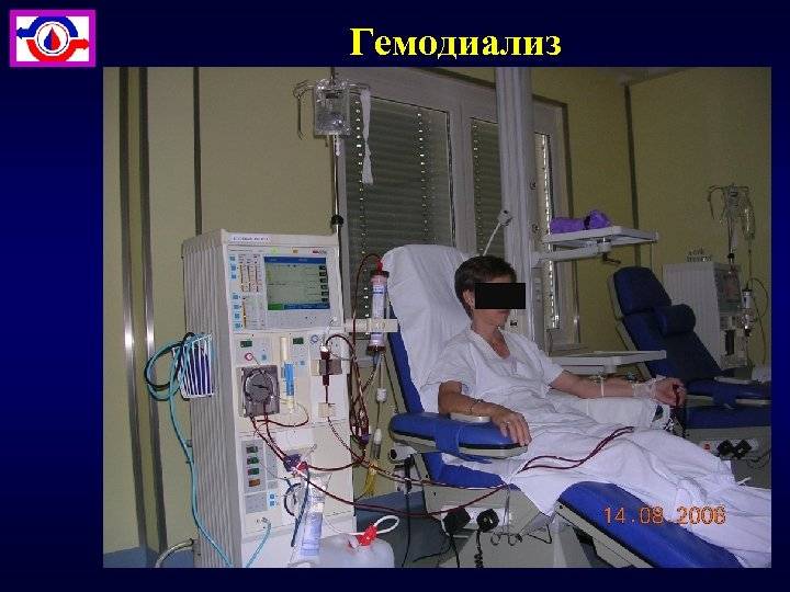 Отдых в россии с гемодиализом